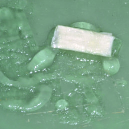 Hyaluronic acid gel, hyadent BG, applied on pericardiummembrane, Smartbrane