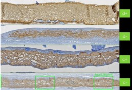 Histology of pericardium membrane with hyadent BG