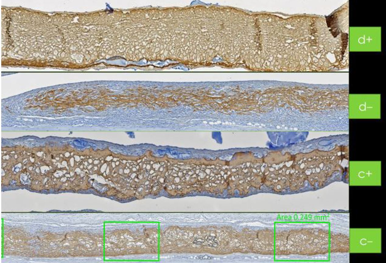 Istologia della membrana del pericardio con hyadent BG